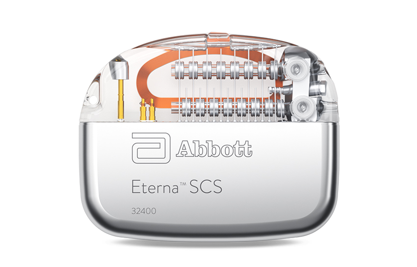Eterna™ Spinal Cord Stimulation System