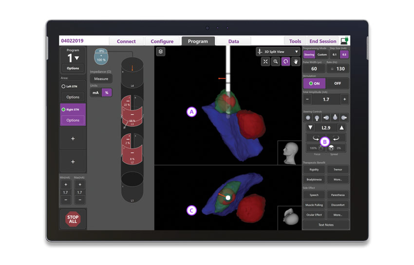 STIMVIEW™ XT