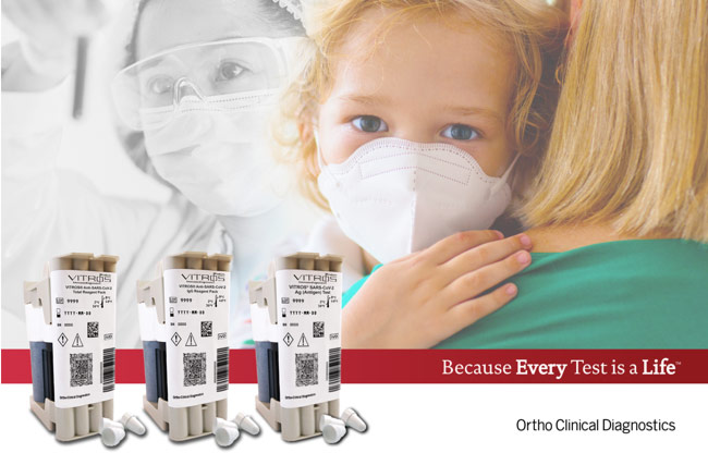Ortho’s VITROS® COVID-19 Testing Solutions: –VITROS®
          Immunodiagnostic Products Anti-SARS-CoV-2 Total test; –VITROS®
          Immunodiagnostic Products Anti-SARS-CoV-2 IgG Antibody test; –VITROS®
          Immunodiagnostic Products SARS-CoV-2 Antigen test