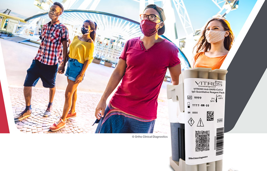 VITROS® Anti-SARS-CoV-2 IgG Quantitative Test